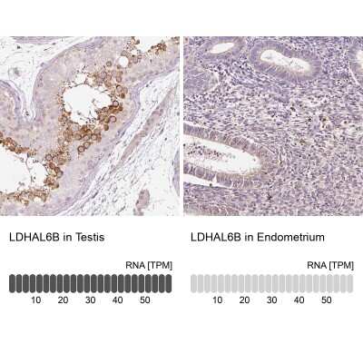 Immunohistochemistry-Paraffin: LDHAL6B Antibody [NBP2-49107]