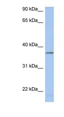 Western Blot: LDHAL6B Antibody [NBP1-55494]