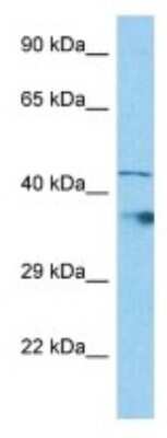 Western Blot: LDHAL6B Antibody [NBP3-10093]