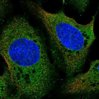 Immunocytochemistry/ Immunofluorescence: LDHD Antibody [NBP2-57116]