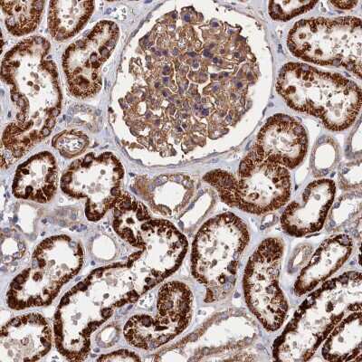 Immunohistochemistry: LDHD Antibody [NBP2-48748]