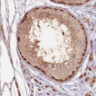 Immunohistochemistry-Paraffin: LDHD Antibody [NBP2-30523]