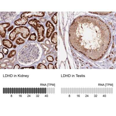 Immunohistochemistry-Paraffin: LDHD Antibody [NBP2-30523]