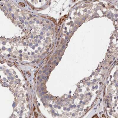 Immunohistochemistry-Paraffin: LDHD Antibody [NBP2-48748]
