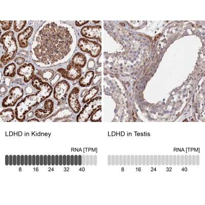 Immunohistochemistry-Paraffin: LDHD Antibody [NBP2-48748]