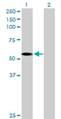 Western Blot: LDHD Antibody [H00197257-B01P]