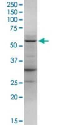 Western Blot: LDHD Antibody [H00197257-D01P]