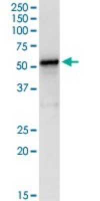 Western Blot: LDHD Antibody [H00197257-D01P]