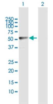 Western Blot: LDHD Antibody [H00197257-D01P]