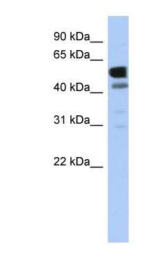 Western Blot: LDHD Antibody [NBP1-56558]