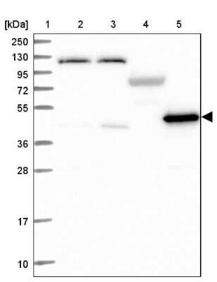 Western Blot: LDHD Antibody [NBP2-48748]