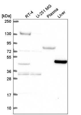 Western Blot: LDHD Antibody [NBP2-57116]