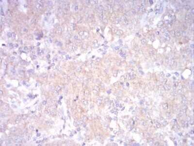 Immunohistochemistry: LDLR Antibody (1B10H10) - BSA Free [NBP2-52502]