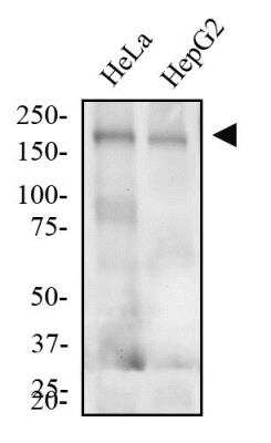 Western Blot: LDLR Antibody (C7) [NBP1-78159]