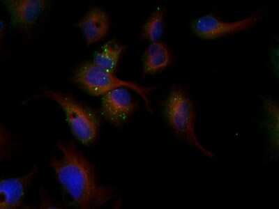 Immunocytochemistry/ Immunofluorescence: LDLR Antibody - BSA Free [NBP1-06709]
