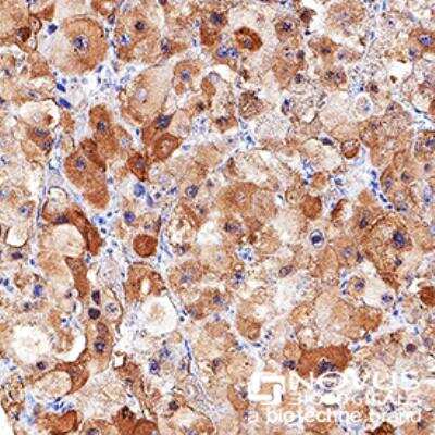 Immunohistochemistry-Paraffin: LDLR Antibody - BSA Free [NBP1-06709]