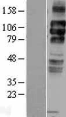 Western Blot: LDLR Overexpression Lysate [NBL1-12475]