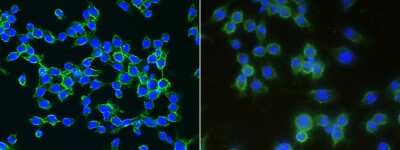 Immunocytochemistry/ Immunofluorescence: LDLR Antibody (032) [NBP2-90523]