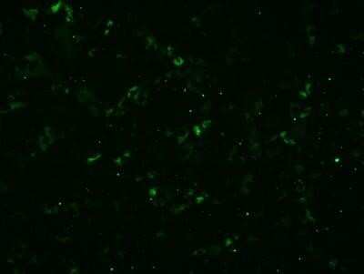 Immunocytochemistry/ Immunofluorescence: LDLR Antibody (C7) - Azide and BSA Free [NBP2-80833]