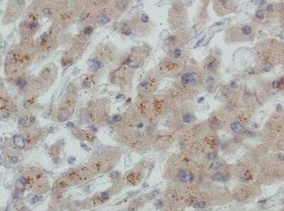 Immunohistochemistry-Paraffin: LDLR Antibody (C7) - Azide and BSA Free [NBP2-80833]