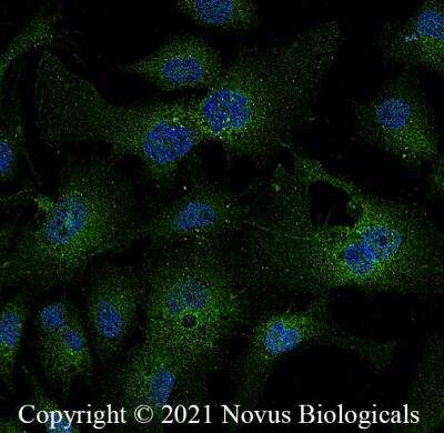 Immunocytochemistry/ Immunofluorescence: LDLR Antibody - BSA Free [NBP1-06709]