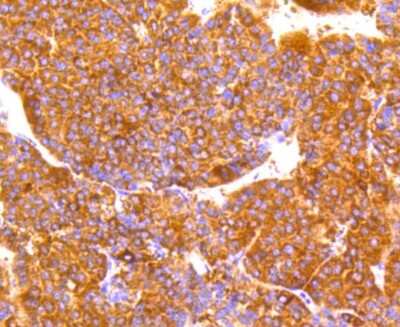 Immunohistochemistry-Paraffin: LDLR Antibody (SJ0197) [NBP2-67414]