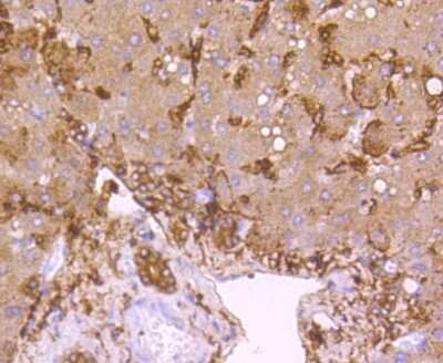 Immunohistochemistry-Paraffin: LDLR Antibody (SJ0197) [NBP2-67414]
