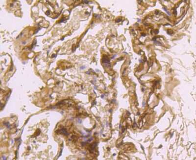 Immunohistochemistry-Paraffin: LDLR Antibody (SJ0197) [NBP2-67414]