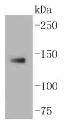 Western Blot: LDLR Antibody (SJ0197) [NBP2-67414]