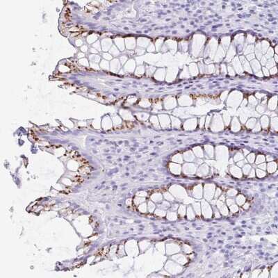 Immunohistochemistry: LDLRAD1 Antibody [NBP2-49047]