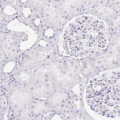 Immunohistochemistry-Paraffin: LDLRAD1 Antibody [NBP2-49047]