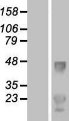 Western Blot: LDLRAD1 Overexpression Lysate [NBP2-08775]