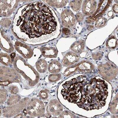 Immunohistochemistry-Paraffin: LDLRAD2 Antibody [NBP1-86339]