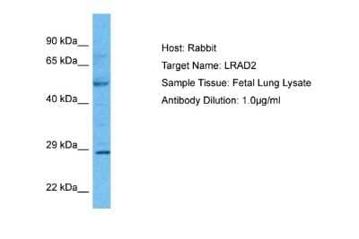 Western Blot: LDLRAD2 Antibody [NBP2-83139]