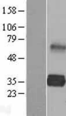 Western Blot: LDLRAD2 Overexpression Lysate [NBL1-12476]