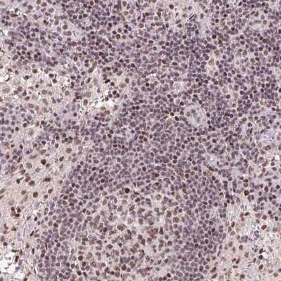 Immunohistochemistry: LDLRAD4 Antibody [NBP2-38061]