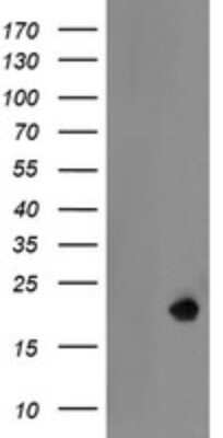 Western Blot: LDOC1 Antibody (OTI1A2) [NBP2-45785]