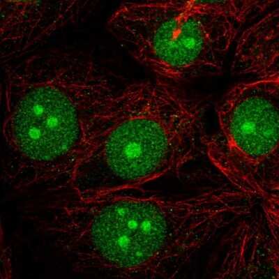 Immunocytochemistry/ Immunofluorescence: LDOC1 Antibody [NBP2-57418]