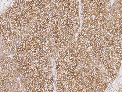 Immunohistochemistry-Paraffin: LDOC1 Antibody [NBP2-99219]