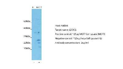 Western Blot: LDOC1 Antibody [NBP1-80323]