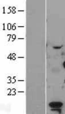 Western Blot: LDOC1 Overexpression Lysate [NBL1-12479]