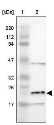 Western Blot: LDOC1L Antibody [NBP1-85207]