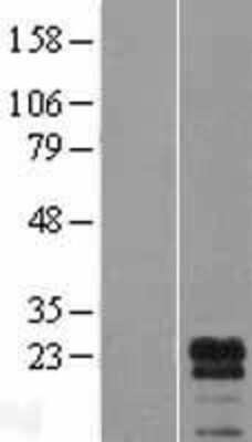 Western Blot: LDOC1L Overexpression Lysate [NBL1-12480]