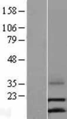 Western Blot: CCL16/HCC-4/LEC Overexpression Lysate [NBL1-08846]