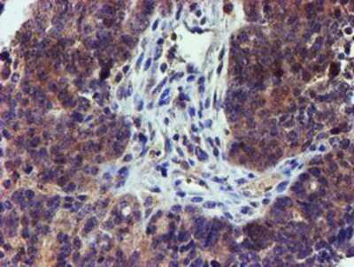 Immunohistochemistry-Paraffin: LECT2 Antibody (OTI2A11) [NBP2-01632]