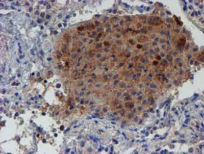 Immunohistochemistry-Paraffin: LECT2 Antibody (OTI2A11) [NBP2-01632]
