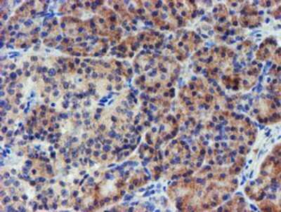 Immunohistochemistry-Paraffin: LECT2 Antibody (OTI2A11) [NBP2-01632]