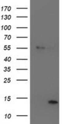 Western Blot: LECT2 Antibody (OTI2A11) [NBP2-01632]