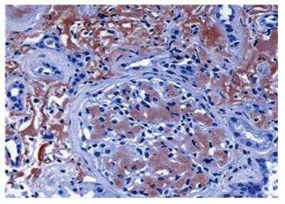 Immunohistochemistry: LECT2 Antibody (MM0449-4B24) - Azide and BSA Free [NBP2-11768]