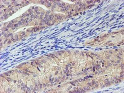 Immunohistochemistry: LECT2 Antibody (OTI2A11) - Azide and BSA Free [NBP2-71122]